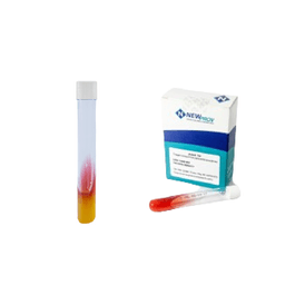 AGAR TRIPTICO ACUCAR FERRO (TSI) 13x100mm (4ml) NEWPROV