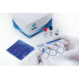 VDRL PRONTO USO 5 ml  COM CONTROLE 55250C-F 250 TESTES WAMA