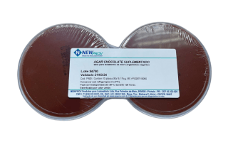 agar choc-Photoroom.png